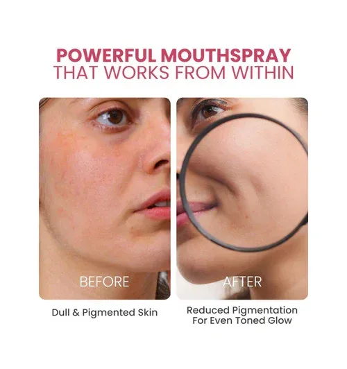 Gluta Glow Mouthspray - NutriSpray