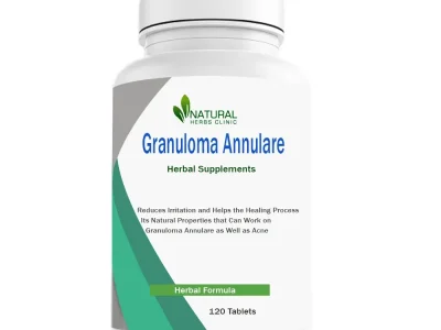 Herbal Supplement for Granuloma Annulare