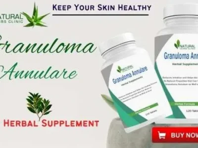 Herbal Supplement for Granuloma Annular