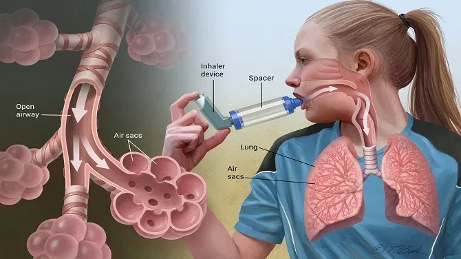 Best Homeopathic Treatment For Asthma - CCube Homeopathy