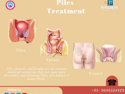 Fistula and Fissure Hospital in Khanna